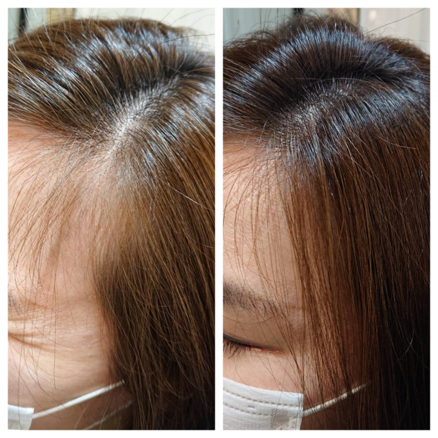 髪のボリュームアップ 増毛エクステ フエール で前髪や分け目の悩みも解消 Hanabusa Co Medical
