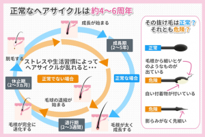 正常なヘアサイクルは約4~6周年