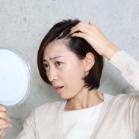 脱毛症に悩む女性