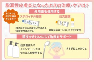 脂漏性皮膚炎になったときの治療・ケアは？